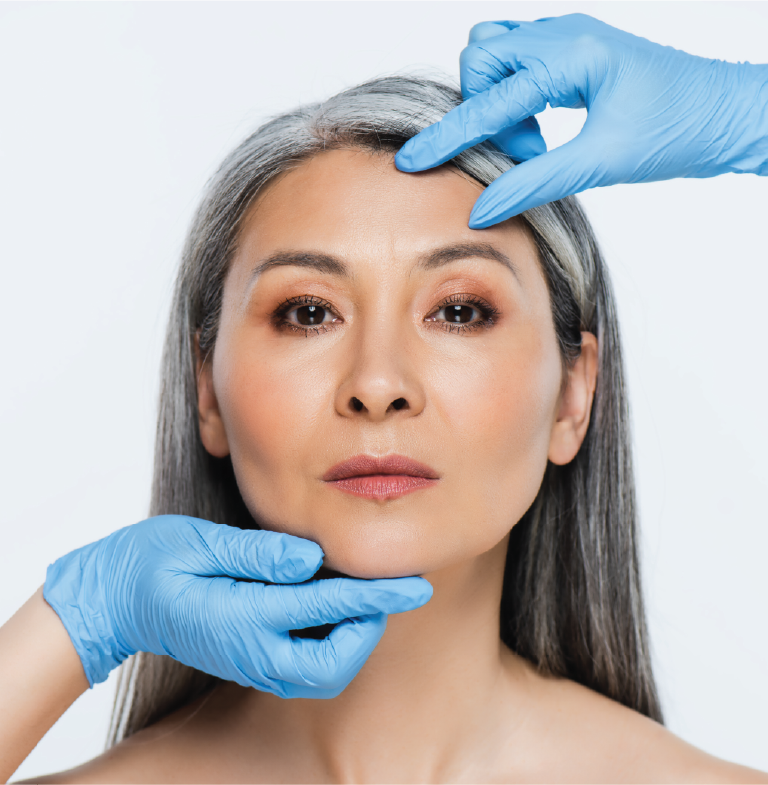 facelift-4