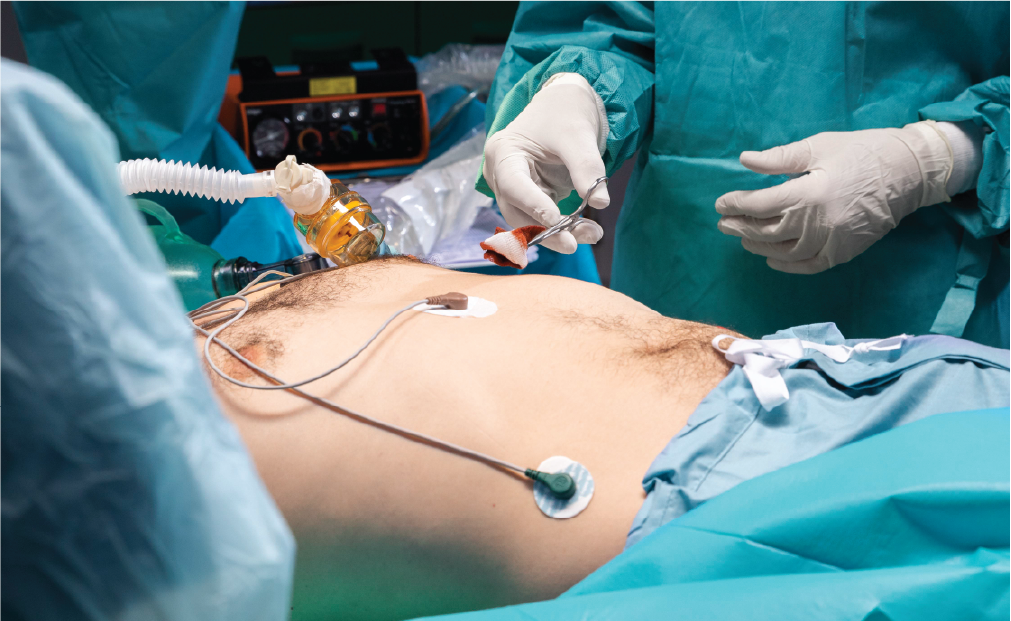 gastric-balloon-3