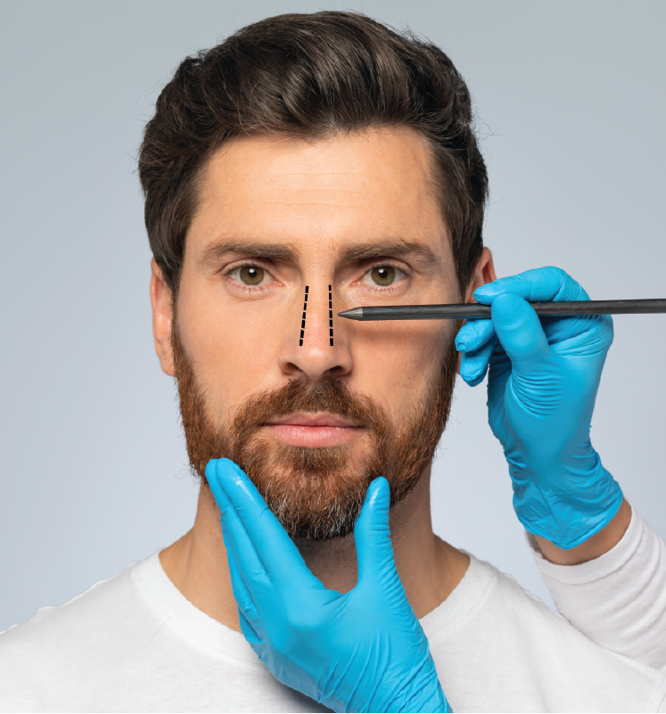 rhinoplasty-1